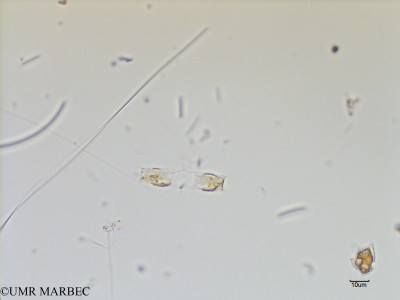 phyto/Scattered_Islands/mayotte_lagoon/SIREME May 2016/Chaetoceros distans (MAY5_chaetoceros b-7).tif(copy)_thumb.jpg